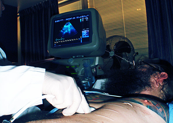 scan-ultrasound